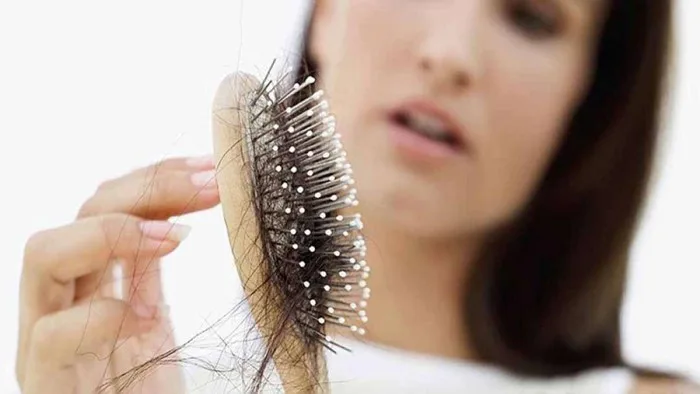 Rụng tóc nhiều là bệnh gì? Nguyên nhân và cách trị rụng tóc tại nhà Rụng tóc nhiều là bệnh gì? Nguyên nhân và cách trị rụng tóc tại nhà