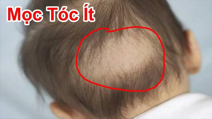 Cách Giúp Cho Trẻ Nhỏ Tóc Mọc Chậm , Ít Tóc Trở Nên Nhiều Tóc / Cách Làm  Cho Con Nhỏ Mọc Nhiều Tóc
