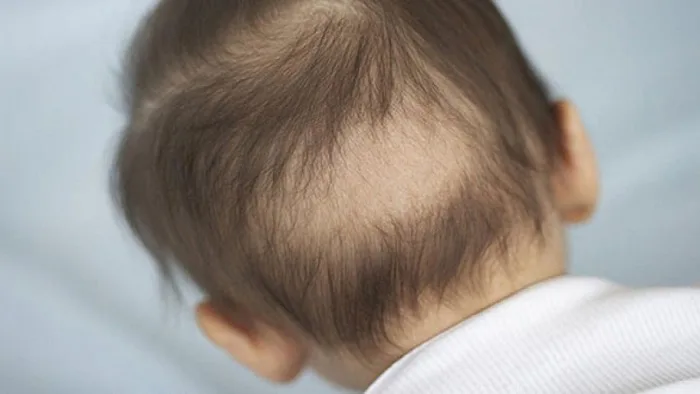 Nguyên Nhân Và Cách Khắc Phục Tóc Mọc Không Đều Ở Trẻ