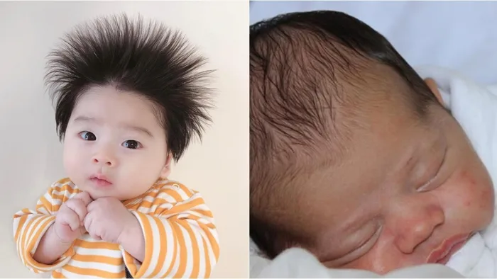 Tóc trẻ sơ sinh mọc dựng đứng kèm theo biểu hiện này cần đi khám bác sĩ