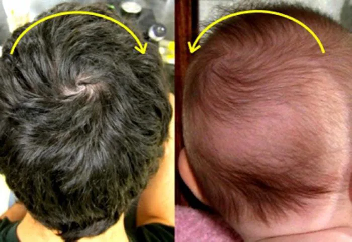 Trẻ có 2 xoáy tóc dễ có IQ hơn người? Chuyên gia giải đáp và chỉ ra nếu có  4 dấu hiệu sau thì đích thị là thiên tài
