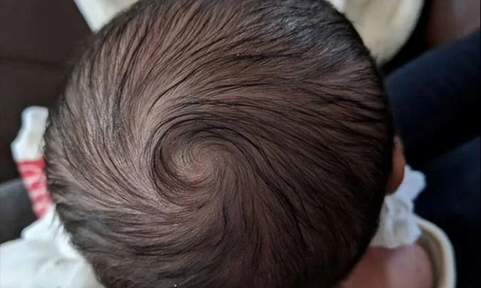 Có câu: Trẻ em càng có “xoáy tóc” rõ trên đầu sẽ càng thông minh hơn, điều  này đúng hay sai? khoa học hơn đang đến