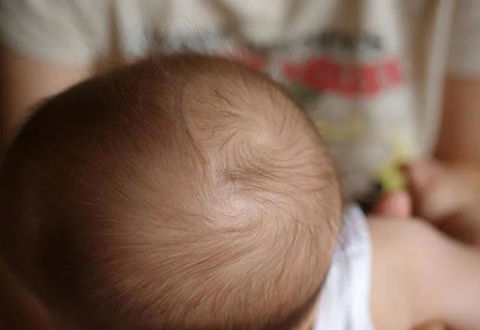 Nhìn xoáy tóc của trẻ sơ sinh biết vận mệnh tương lai, kiểu thứ 6 thông  minh bẩm sinh