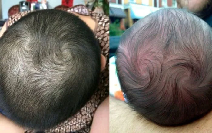 Thực hư việc trẻ có 2 xoáy tóc là biểu hiện IQ cao và thông minh hơn
