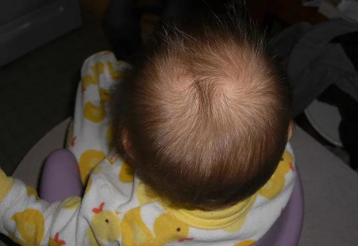 Nhìn xoáy tóc của trẻ sơ sinh biết vận mệnh tương lai, kiểu thứ 6 thông  minh bẩm sinh