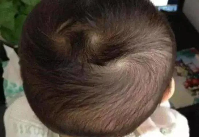 Nhìn xoáy tóc biết vận mệnh, trẻ có 2 xoáy đầu thường nghịch ngợm, tài giỏi  hơn người