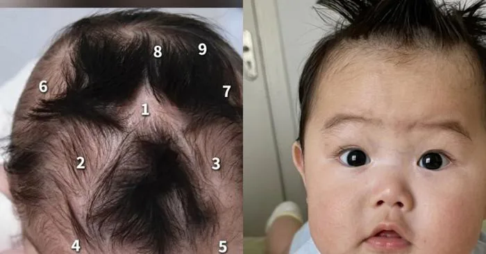 Em bé gây chú ý vì có tới 9 xoáy tóc trên đầu: Liệu có điều gì đặc biệt  liên quan đến não bộ của bé?