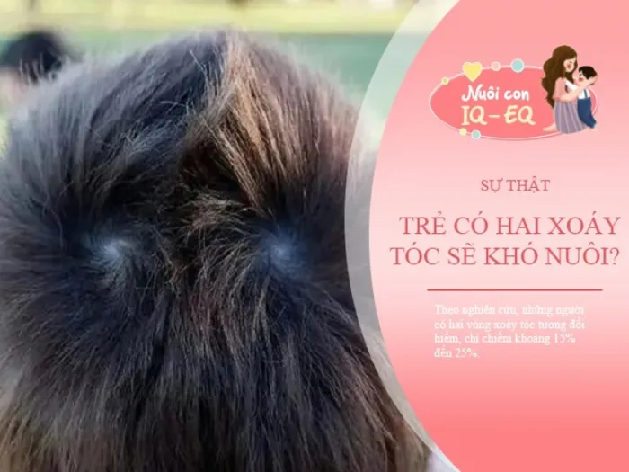 Trẻ có hai xoáy trên đầu sẽ khó nuôi Nghiên cứu khoa học tiết lộ sự thật