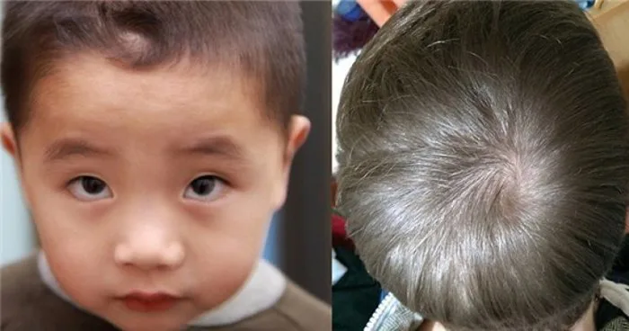 Xem Xoáy Tóc Trẻ Em Để Biết Tương Lai Vận Mệnh Đứa Trẻ
