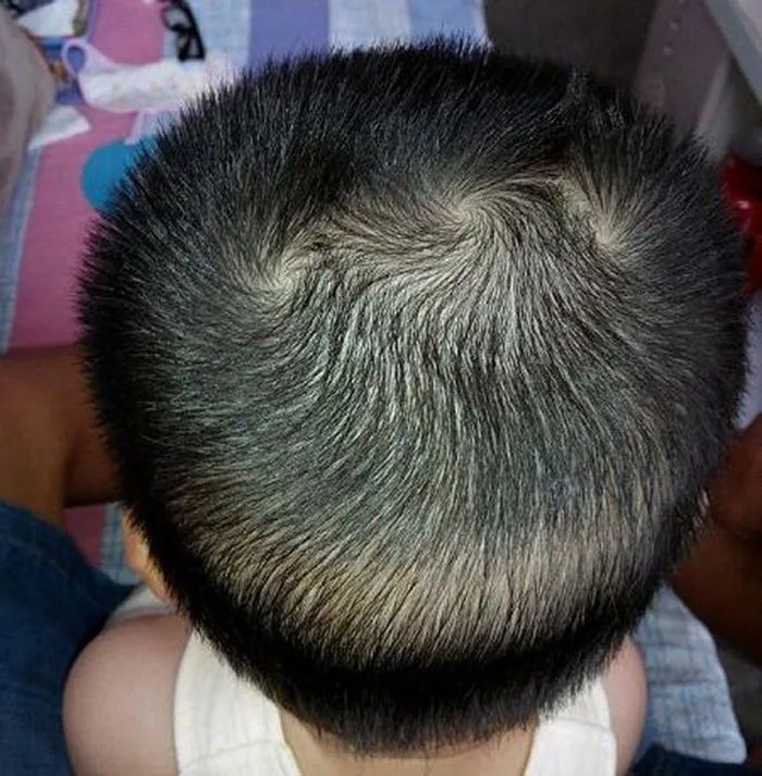 Người có 3 xoáy cá tính rất mạnh mẽ - Barber Shop Vũ Trí