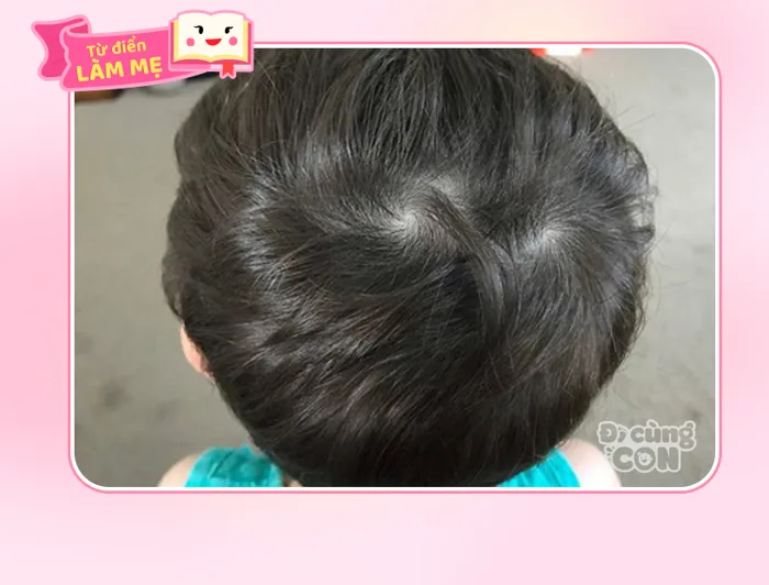 Xoáy tóc là gì mà được cho là quyết định tính cách bé? - Đi cùng con