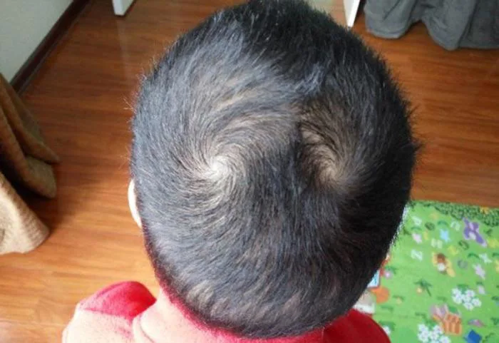 Nhìn xoáy tóc của trẻ sơ sinh biết vận mệnh tương lai, kiểu thứ 6 thông  minh bẩm sinh