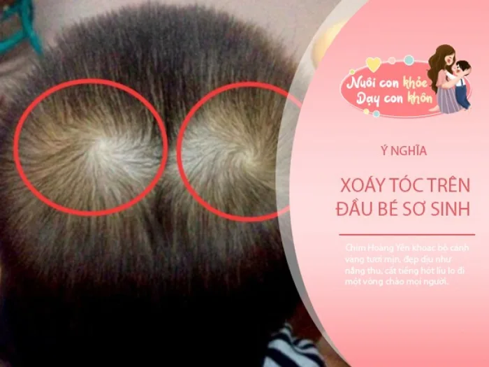 Em bé có nhiều xoáy tóc thì càng thông minh Khoa học đưa ra giải thích rõ  ràng