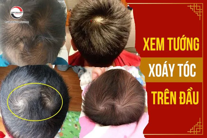 Xem tướng xoáy tóc trên đầu