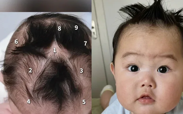 Em bé gây chú ý vì có tới 9 xoáy tóc trên đầu: Liệu có điều gì đặc biệt  liên quan đến não bộ của bé?