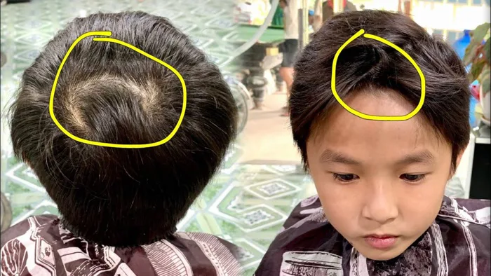Trẻ nhỏ có 2 xoáy tóc rõ trên đầu sẽ càng thông minh hơn, bác sĩ nói gì?