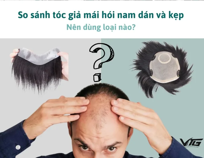 So Sánh Tóc Giả Mái Hói Nam Dán Và Kẹp, Nên Dùng Loại Nào? | VTG Hair
