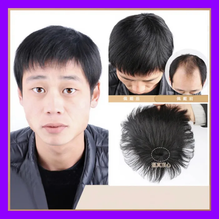 Tóc Giả Kẹp Che Hói Nam - Dễ Kẹp - Nhẹ Đầu (3111) | Shopee Việt Nam