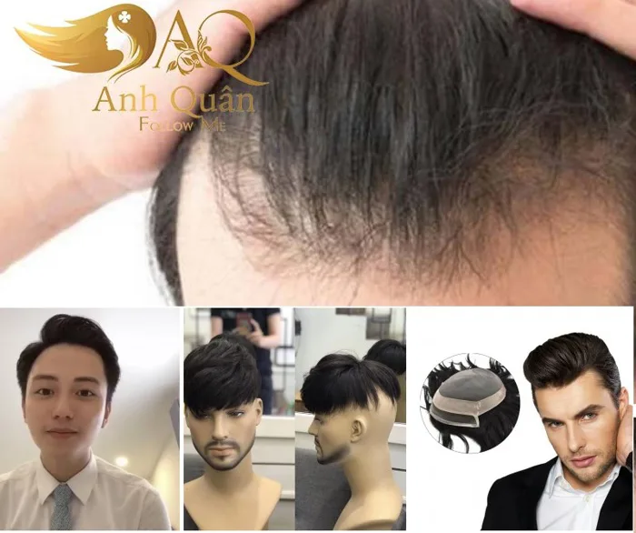 Kiểu tóc giả che hói cho mái hói nam nữ đẹp như thật! - TocgiaCaocap.Com