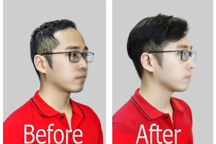 Tóc giả nam - Giải pháp số 1 cho người hói đầu rụng tóc