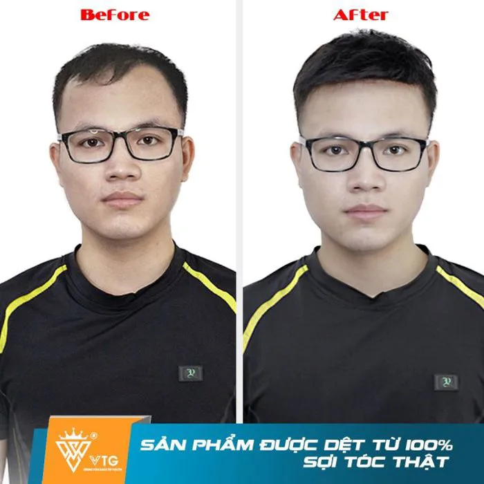 Tóc giả nam dạng kẹp VTG D02 đế lưới siêu thoáng, xoáy siêu da đầu cao