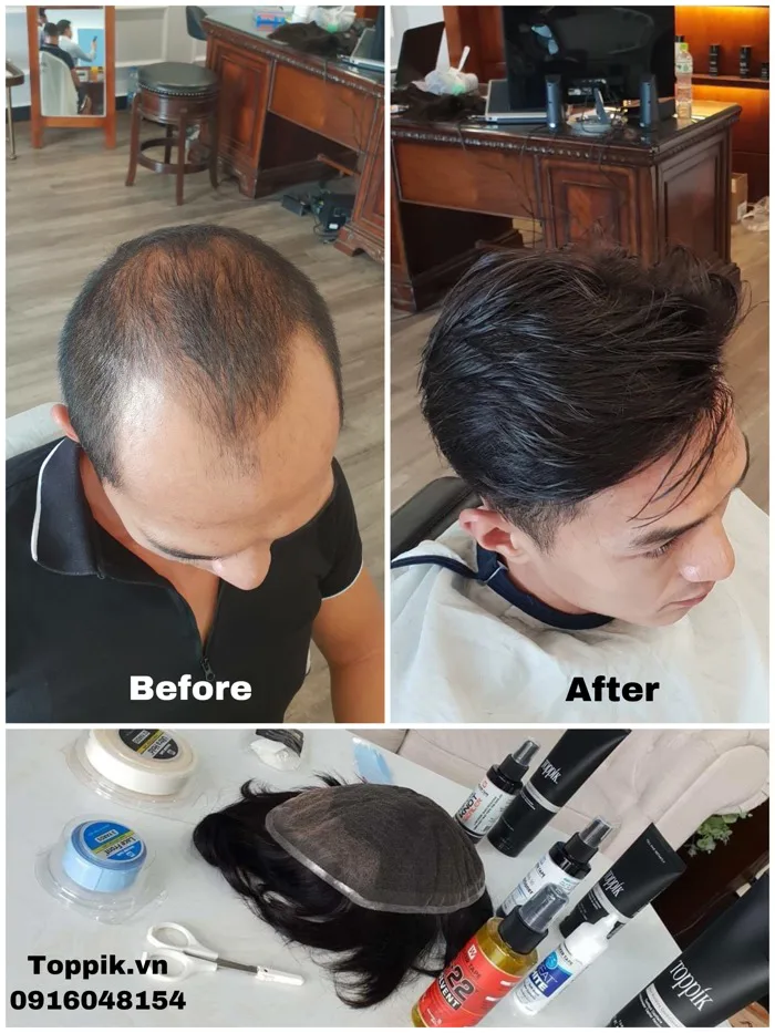 TÓC GIẢ MÁI HÓI MỸ HAIR REPLACEMENT SYSTEM POLY PU SKIN - Toppik