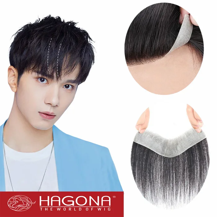 Tóc giả che hói chữ M che hói bò liếm ở nam giới