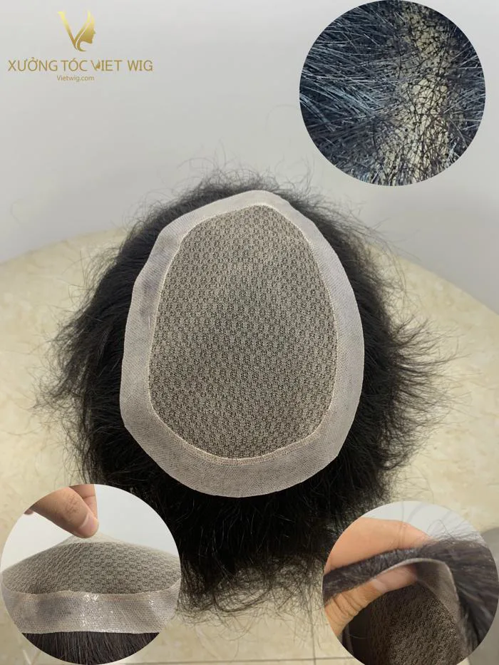 Tóc giả che hói đỉnh đầu nam giới dạng dán - kiểu Australia viền poly và  lưới lace - Viet Wig - Wig made in Viet Nam