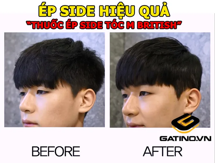 Ép side tóc nam giá bao nhiêu? Thuốc ép side tóc nam tại nhà tiện lợi Ép side tóc nam giá bao nhiêu? Thuốc ép side tóc nam tại nhà tiện lợi