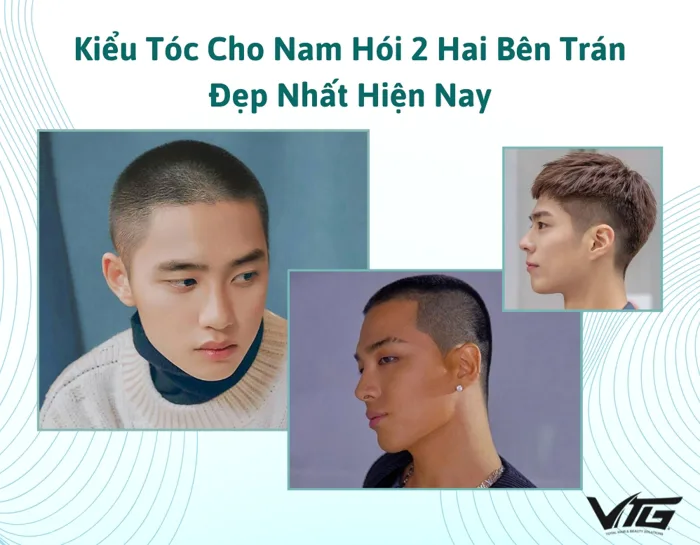 TOP 10+ Kiểu Tóc Cho Nam Hói 2 Hai Bên Trán Đẹp Nhất Hiện Nay TOP 10+ Kiểu Tóc Cho Nam Hói 2 Hai Bên Trán Đẹp Nhất Hiện Nay