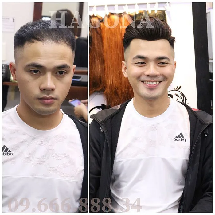 TOP những kiểu tóc cho nam bị hói trán cực đẹp TOP những kiểu tóc cho nam bị hói trán cực đẹp