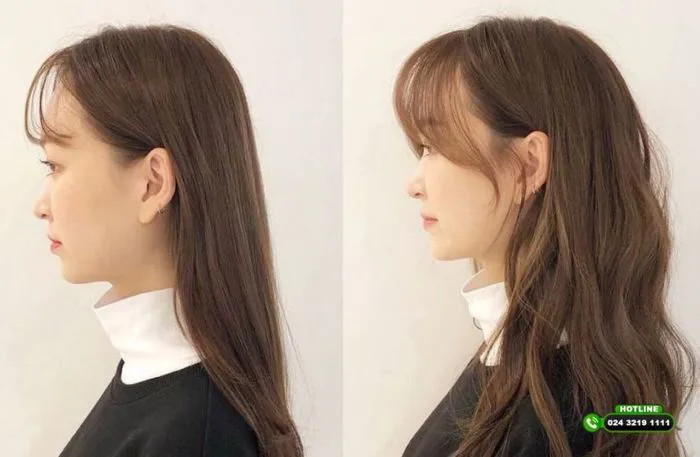 TOP 5 kiểu tóc che hói đỉnh đầu nữ giúp che khuyết điểm hiệu quả