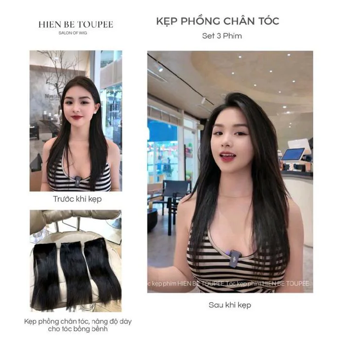 Phân tích Thị phần cạnh tranh và Top thương hiệu ở Nhóm hàng Kẹp tóc sau đầu trên sàn TMĐT cập nhật tháng 08/2026